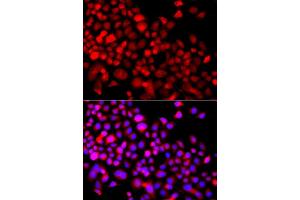 Immunofluorescence analysis of A549 cell using CALCOCO1 antibody. (CALCOCO1 anticorps)