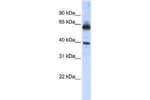 WB Suggested Anti-KPNA1 Antibody Titration: 0. (KPNA1 anticorps  (N-Term))