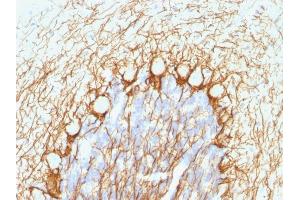 Formalin-fixed, paraffin-embedded human Cerebellum stained with Neurofilament Mouse Monoclonal Antibody (NE14). (NEFH anticorps)