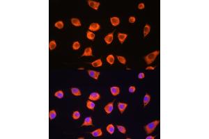 Immunofluorescence analysis of L929 cells using SCYL2 Rabbit pAb (ABIN6132636, ABIN6147463, ABIN6147465 and ABIN6217078) at dilution of 1:100. (SCYL2 anticorps  (AA 1-300))