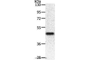 Western blot analysis of Mouse heart tissue, using PDK2 Polyclonal Antibody at dilution of 1:500