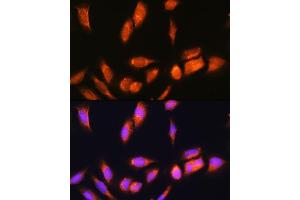anti-SCY1-Like 2 (SCYL2) (AA 1-300) antibody