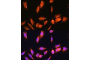 Immunofluorescence analysis of U2OS cells using SCYL2 Rabbit pAb (ABIN6132636, ABIN6147463, ABIN6147465 and ABIN6217078) at dilution of 1:100. (SCYL2 anticorps  (AA 1-300))