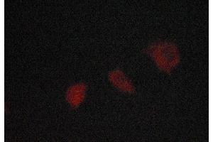 ABIN6267071 staining lovo cells by ICC/IF.