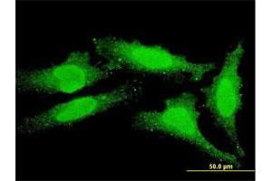 Immunofluorescence of monoclonal antibody to FOXO1 on HeLa cell. (FOXO1 anticorps  (AA 556-655))