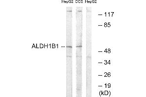 Western blot analysis of extracts from HepG2 cells and COS cells, using ALDH1B1 antibody. (ALDH1B1 anticorps)