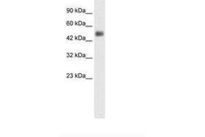 Image no. 3 for anti-Glial Cells Missing Homolog 1 (GCM1) (N-Term) antibody (ABIN6735857) (GCM1 anticorps  (N-Term))