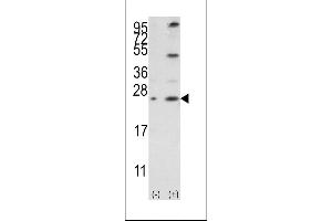 Western blot analysis of Bcl-w3 using rabbit polyclonal Bcl-w BH3 Domain Antibody using 293 cell lysates (2 ug/lane) either nontransfected (Lane 1) or transiently transfected with the BCL2L2 gene (Lane 2).