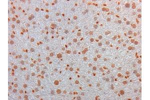 Immunohistochemistry of Mouse Monoclonal anti AKT3 Antibody in Mouse Embryonic Kidney Tissue: Mouse Liver Fixation: FFPE buffered formalin 10% conc Ag Retrieval: Heat, Citrate pH 6.