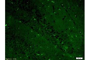 Formalin-fixed and paraffin-embedded rat brain labeled with Anti-ERK2/MAPK1 Polyclonal Antibody, Unconjugated (ABIN723725) 1:200, overnight at 4°C, The secondary antibody was Goat Anti-Rabbit IgG, FITC conjugated used at 1:200 dilution for 40 minutes at 37°C.