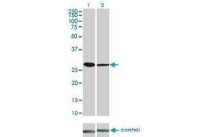 Western blot analysis of CDK4 over-expressed 293 cell line, cotransfected with CDK4 Validated Chimera RNAi (Lane 2) or non-transfected control (Lane 1). (CDK4 anticorps  (AA 211-303))