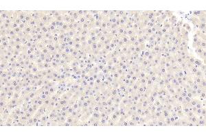Detection of F2 in Rat Liver Tissue using Polyclonal Antibody to Coagulation Factor II (F2) (Prothrombin anticorps  (AA 44-200))