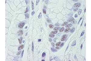 Immunohistochemistry (IHC) image for anti-Cyclin-Dependent Kinase 11B (CDK11B) (C-Term) antibody (ABIN7448470) (CDK11 anticorps  (C-Term))