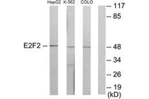 Western blot analysis of extracts from HepG2/K562/COLO205 cells, using E2F2 Antibody. (E2F2 anticorps  (AA 221-270))