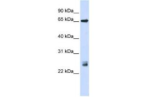 Western Blotting (WB) image for anti-Tripartite Motif Containing 8 (TRIM8) antibody (ABIN2458426) (TRIM8 anticorps)
