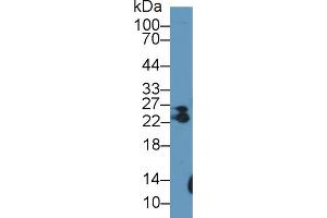 Western Blot; Sample: Rat Skeletal muscle lysate; Primary Ab: 1µg/ml Rabbit Anti-Human MYL6B Antibody Second Ab: 0.