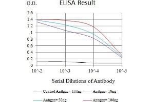 Black line: Control Antigen (100 ng),Purple line: Antigen (10 ng), Blue line: Antigen (50 ng), Red line:Antigen (100 ng) (IL7R anticorps  (AA 21-239))