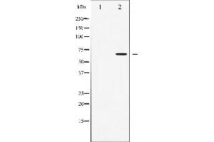 Western blot analysis of AMPK alpha phosphorylation expression in Heatshock treated 293 whole cell lysates,The lane on the left is treated with the antigen-specific peptide.