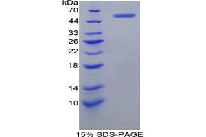 SDS-PAGE analysis of Human Complement Receptor 2 Protein. (CD21 Protéine)