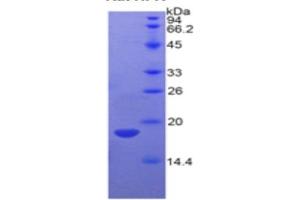 WB of Protein Standard: different control antibodies  against Highly purified E.