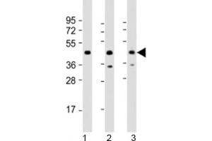 Western blot testing of human 1) 293T/17, 2) Jurkat and 3) K562 cell lysate with PHF6 antibody at 1:2000. (PHF6 anticorps  (AA 148-180))