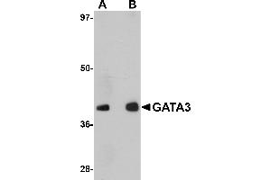Western Blotting (WB) image for anti-GATA Binding Protein 3 (GATA3) (C-Term) antibody (ABIN1030408) (GATA3 anticorps  (C-Term))