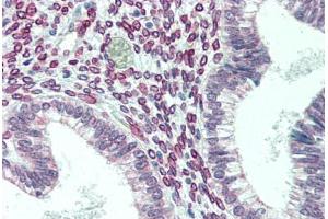 anti-Centromere Protein F (CENPF) (AA 1759-2093) antibody