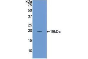 Western blot analysis of recombinant Rat PROCR. (PROCR anticorps  (AA 59-217))