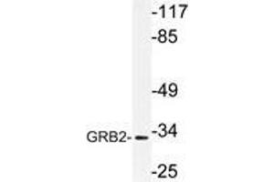Western blot (WB) analysis of GRB2 antibody in extracts from Jurkat cells. (GRB2 anticorps)
