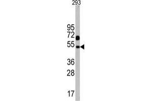 Western blot analysis of Nptx1 Antibody (C-term) in 293 cell line lysates (35 µg/lane). (NPX1 anticorps  (C-Term))