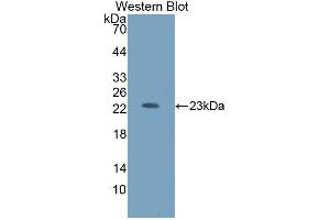 Detection of Recombinant HEXb, Human using Polyclonal Antibody to Hexosaminidase B Beta (HEXb) (HEXB anticorps  (AA 122-311))