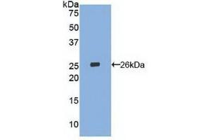 Western blot analysis of recombinant Human LOX1. (OLR1 anticorps  (AA 81-273))