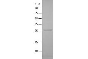 Western Blotting (WB) image for Protein Tyrosine Phosphatase, Receptor Type, N (PTPRN) (AA 107-332) protein (His tag) (ABIN7124687)