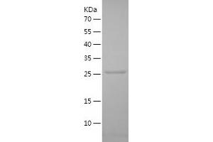 Western Blotting (WB) image for Protein Tyrosine Phosphatase, Receptor Type, N (PTPRN) (AA 107-332) protein (His tag) (ABIN7124687) (PTPRN Protein (AA 107-332) (His tag))