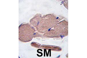 Formalin-fixed and paraffin-embedded human skeletal muscle tissue reacted with MSTN polyclonal antibody  , which was peroxidase-conjugated to the secondary antibody, followed by DAB staining. (MSTN anticorps  (AA 17-46))