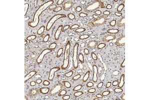 IHC analysis of SFXN5 using anti-SFXN5 antibody (ABIN7601388). (Sideroflexin 5 anticorps  (AA 34-340))