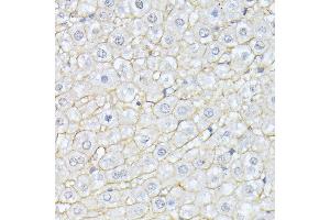 Immunohistochemistry of paraffin-embedded rat liver using Alpha Fodrin antibody (ABIN6128747, ABIN6148403, ABIN6148404 and ABIN6213643) at dilution of 1:100 (40x lens).