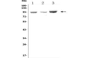 Western blot analysis of FGA using anti-FGA antibody (ABIN7600004).