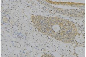 ABIN6277388 at 1/100 staining Human uterus tissue by IHC-P. (IGFBP7 anticorps  (Internal Region))