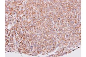 IHC-P Image Immunohistochemical analysis of paraffin-embedded SAS xenograft, using VEGFD, antibody at 1:100 dilution.
