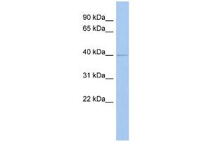 WB Suggested Anti-ZADH2 Antibody Titration: 0. (ZADH2 anticorps  (N-Term))