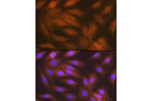 Immunofluorescence analysis of C6 cells using RAIDD/CRADD Rabbit mAb (ABIN7266106) at dilution of 1:100 (40x lens). (CRADD anticorps)