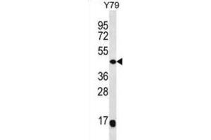 Western Blotting (WB) image for anti-Mitogen-Activated Protein Kinase Kinase 4 (MAP2K4) antibody (ABIN2998350)