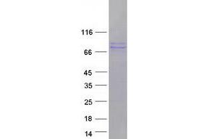 Validation with Western Blot