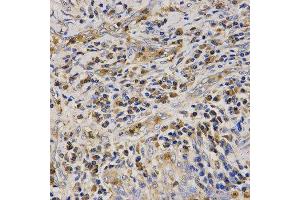 Immunohistochemistry (IHC) image for anti-Cathelicidin Antimicrobial Peptide (CAMP) (AA 31-170) antibody (ABIN3022306)