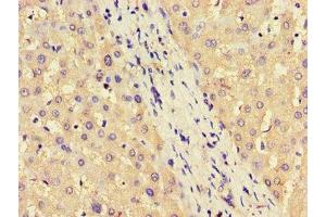 Immunohistochemistry of paraffin-embedded human liver tissue using ABIN7144599 at dilution of 1:100