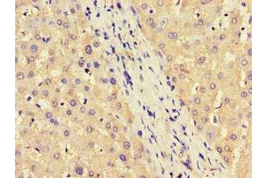 Immunohistochemistry of paraffin-embedded human liver tissue using ABIN7144599 at dilution of 1:100 (ASS1 anticorps  (AA 168-222))