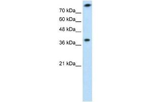 TST antibody used at 1 ug/ml to detect target protein. (TST anticorps)