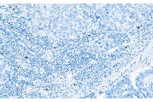 Immunohistochemistry (IHC) image for anti-Granzyme B (GZMB) (AA 19-247) antibody (ABIN7449554) (Recombinant GZMB anticorps  (AA 19-247))