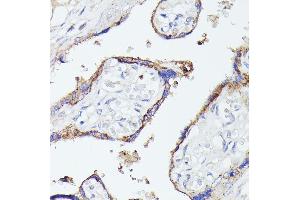 Immunohistochemistry of paraffin-embedded human placenta using LTF antibody (ABIN6131498, ABIN6143382, ABIN6143383 and ABIN6216705) at dilution of 1:100 (40x lens).